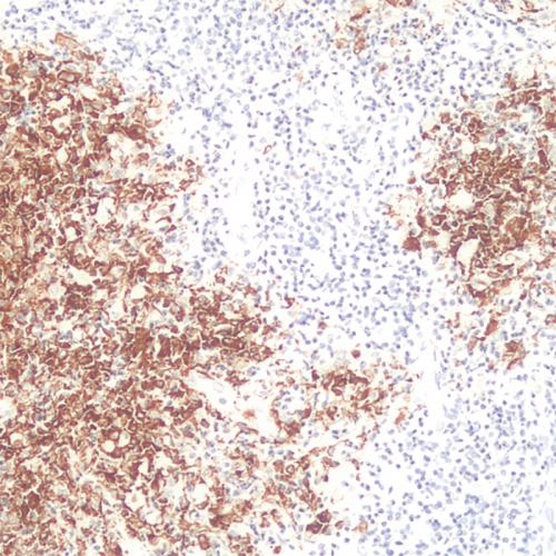 Langerin Antibody Reagent for Immunohistochemistry